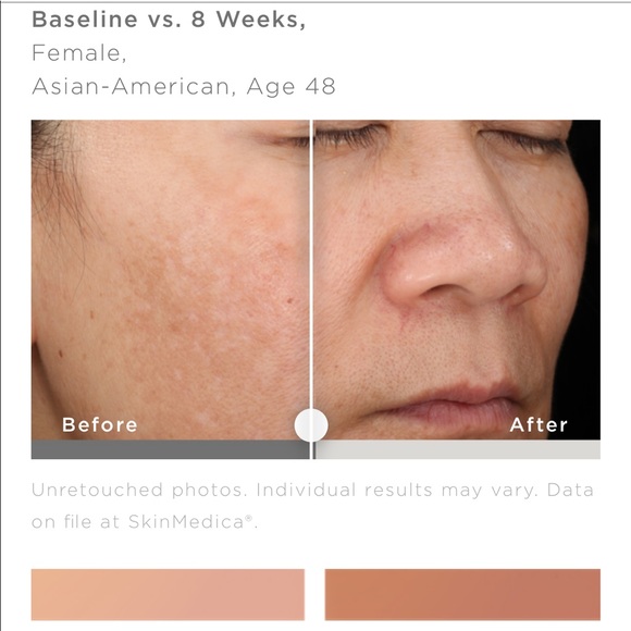 BRAND NEW SKINMEDICA LYTERA 2.0‼️✨ - Picture 5 of 7